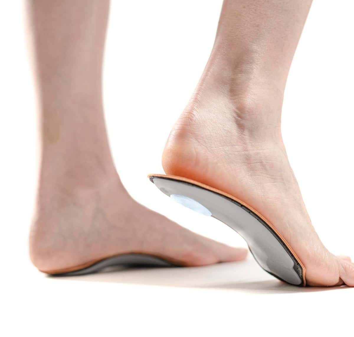 Woman standing in custom orthotics for posterior tibial tendonitis